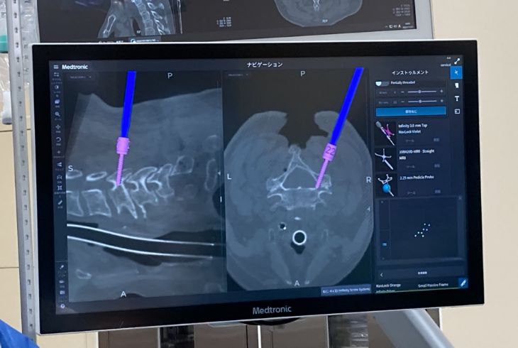 首・腰の脊椎診療に特化